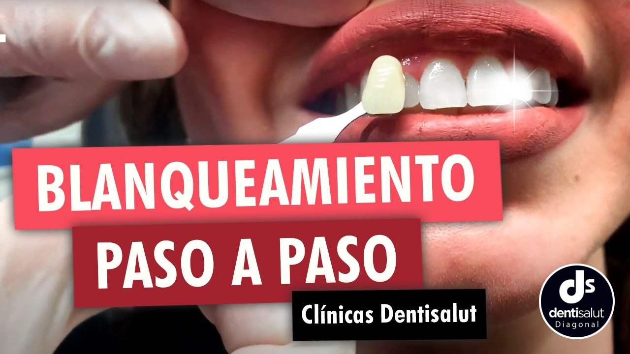 Las mejores clínicas dentales en Daroca de Rioja: todo lo que necesitas saber